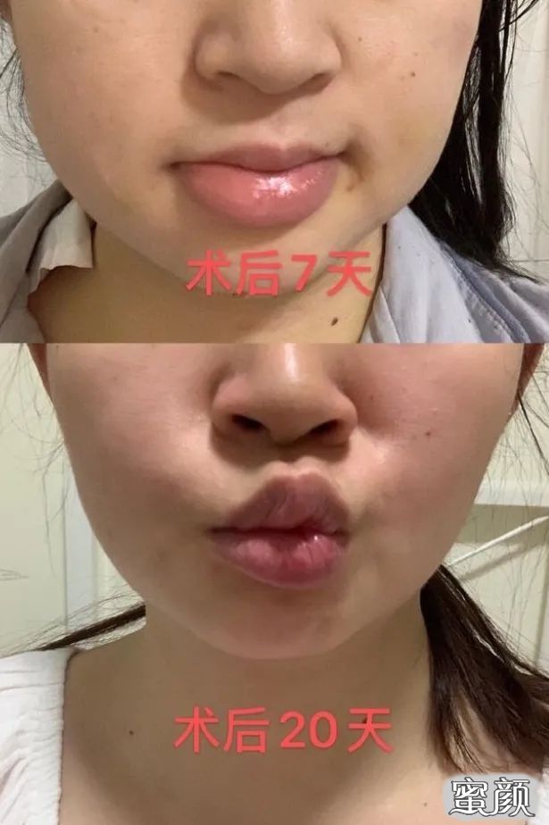 https://img.miyanlife.com/mnt/timg/201208/0I43A419-2.jpg