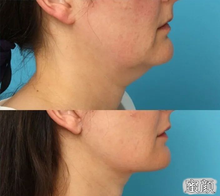 https://img.miyanlife.com/mnt/timg/201208/0I43A535-3.jpg