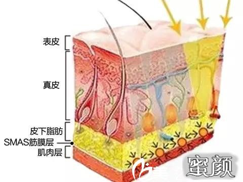 案例图片