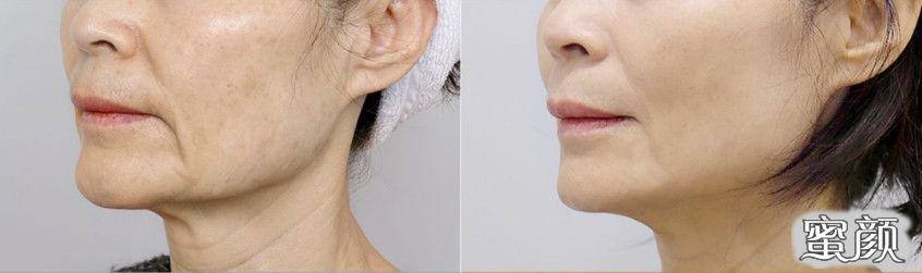 https://img.miyanlife.com/mnt/timg/201209/160153G39-3.jpg