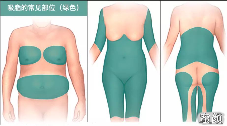 https://img.miyanlife.com/mnt/timg/201209/1605233243-1.jpg