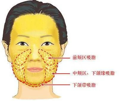 https://img.miyanlife.com/mnt/timg/201209/16122KJ2-7.jpg