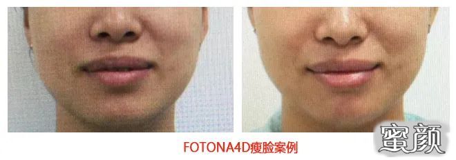 https://img.miyanlife.com/mnt/timg/201211/132601DW-1.jpg