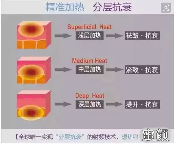 案例图片