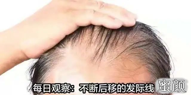 案例图片