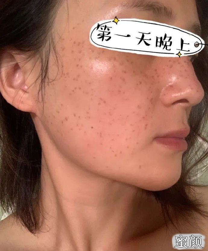 https://img.miyanlife.com/mnt/timg/201217/1AR92T9-3.jpg