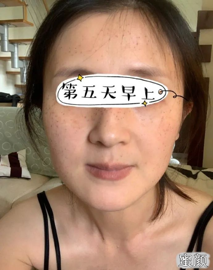 https://img.miyanlife.com/mnt/timg/201217/1AS0M91-4.jpg
