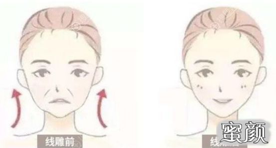https://img.miyanlife.com/mnt/timg/201217/1U4496146-2.jpg