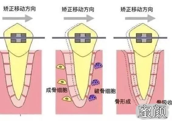 案例图片