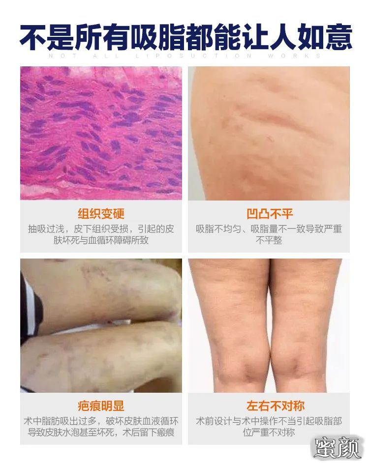 https://img.miyanlife.com/mnt/timg/201218/1951161X2-9.jpg