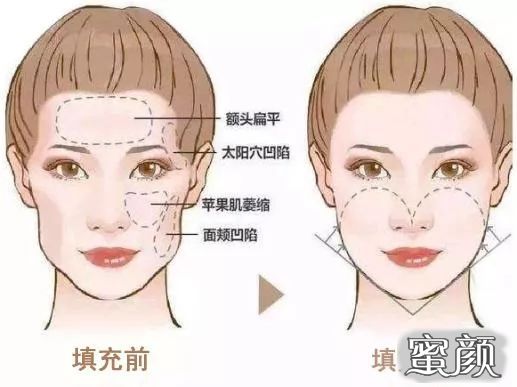 https://img.miyanlife.com/mnt/timg/201218/211544M94-1.jpg