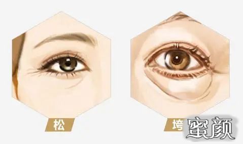 https://img.miyanlife.com/mnt/timg/201218/2155305642-3.jpg