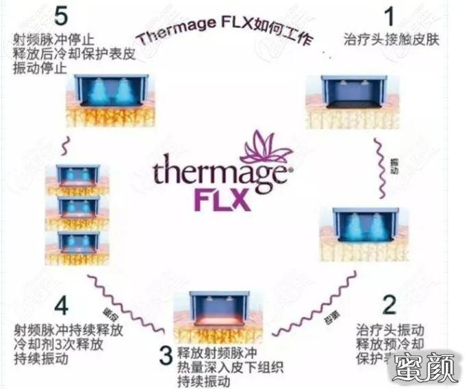 https://img.miyanlife.com/mnt/timg/201219/21151T206-1.jpg