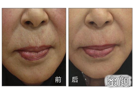 https://img.miyanlife.com/mnt/timg/201219/22250U496-6.jpg