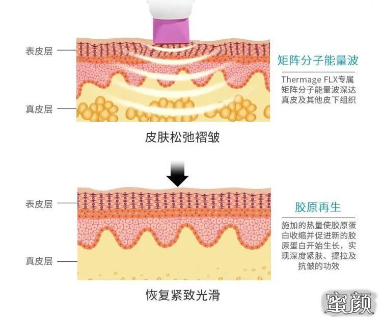 https://img.miyanlife.com/mnt/timg/201221/0H43S112-3.jpg