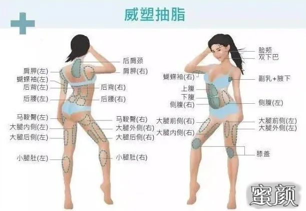https://img.miyanlife.com/mnt/timg/201221/22592223R-6.jpg