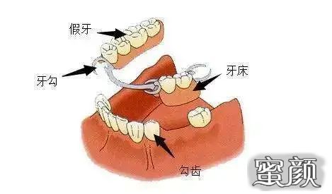 案例图片