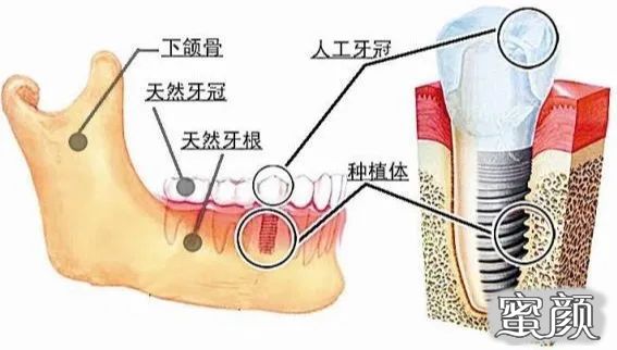 案例图片