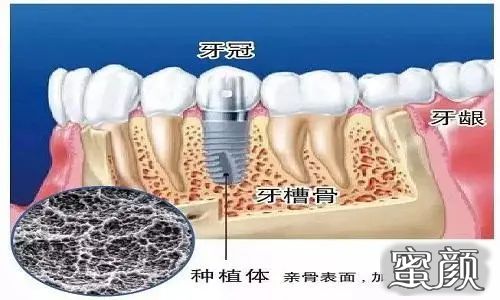 案例图片