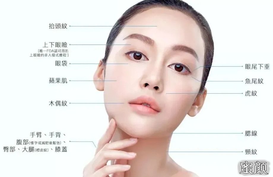 https://img.miyanlife.com/mnt/timg/201224/225R151H-10.jpg