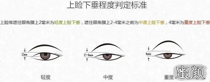 https://img.miyanlife.com/mnt/timg/201224/234Q14313-3.jpg