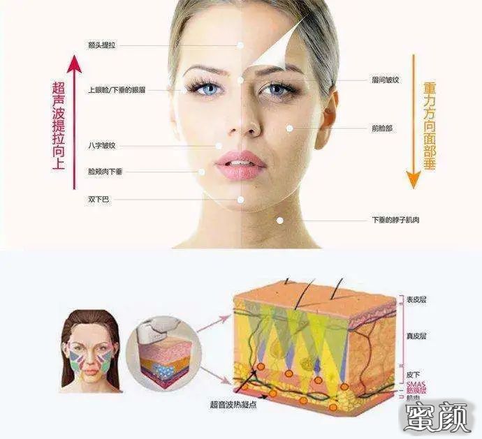 https://img.miyanlife.com/mnt/timg/201225/1940444109-1.jpg