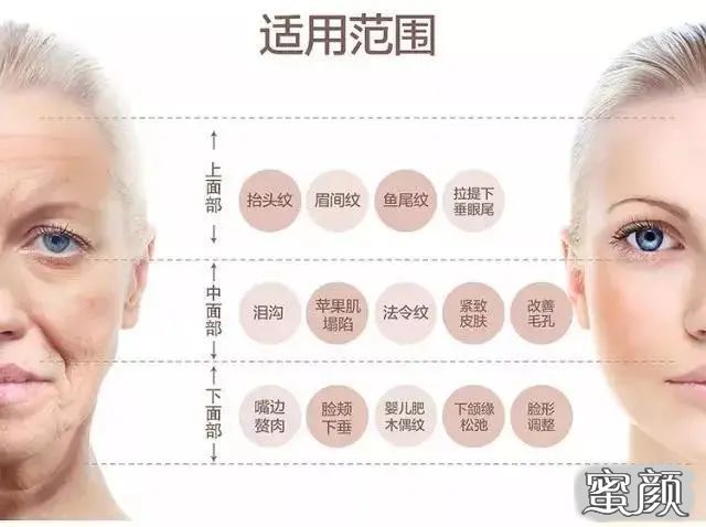 https://img.miyanlife.com/mnt/timg/201225/1940456093-4.jpg