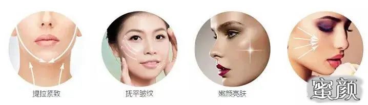 https://img.miyanlife.com/mnt/timg/201225/19404G054-7.jpg