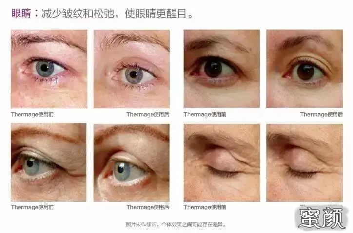 https://img.miyanlife.com/mnt/timg/201225/1G6024C4-1.jpg