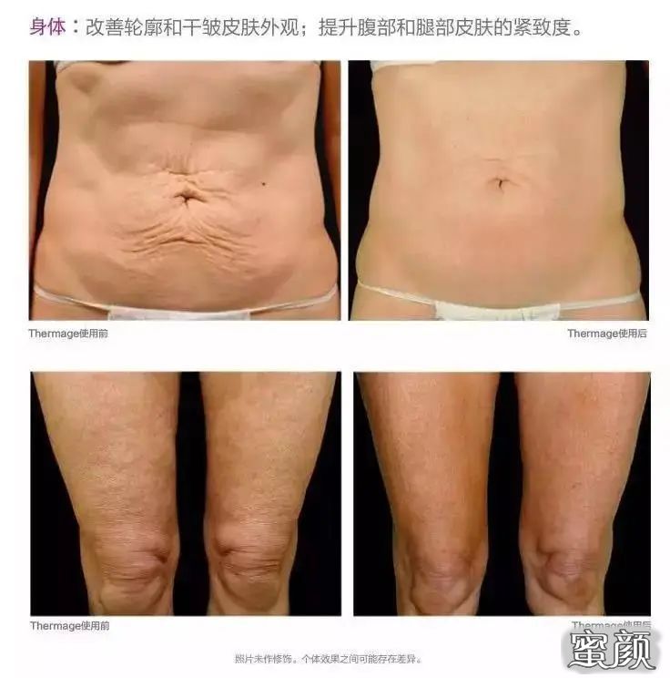https://img.miyanlife.com/mnt/timg/201225/1G6031343-2.jpg