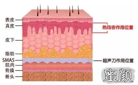 https://img.miyanlife.com/mnt/timg/201225/221JT440-1.jpg