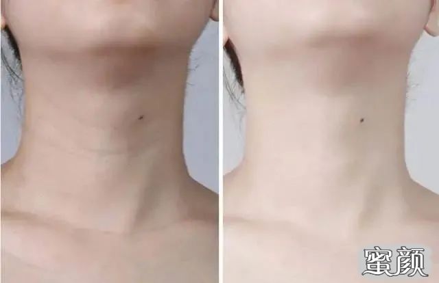 https://img.miyanlife.com/mnt/timg/201226/091H14235-10.jpg