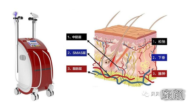 https://img.miyanlife.com/mnt/timg/201226/0H50a560-3.jpg