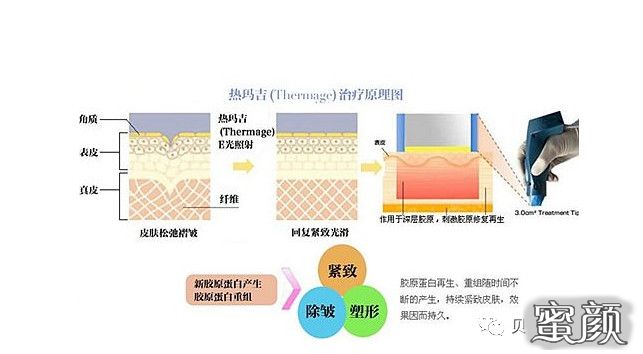 https://img.miyanlife.com/mnt/timg/201226/0H5104244-4.jpg