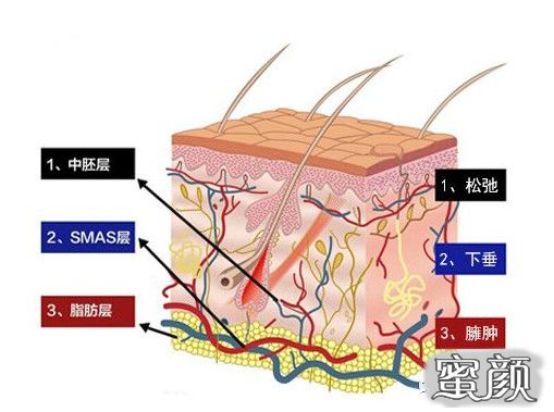 https://img.miyanlife.com/mnt/timg/201226/0H51210I-5.jpg