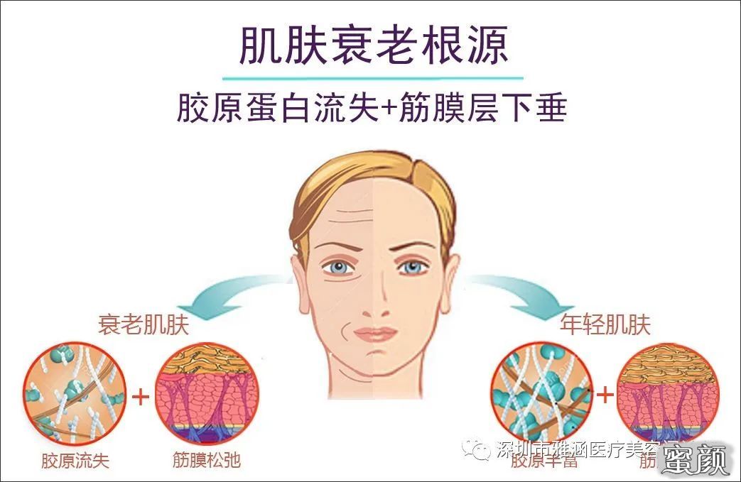 https://img.miyanlife.com/mnt/timg/201226/1939324916-1.jpg