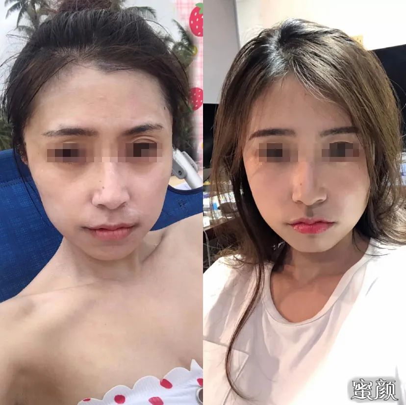 https://img.miyanlife.com/mnt/timg/201226/202KL943-1.jpg