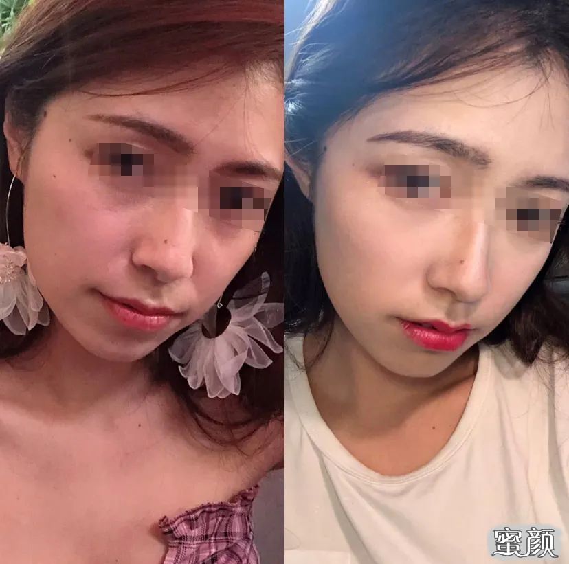 https://img.miyanlife.com/mnt/timg/201226/202KRO3-2.jpg