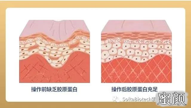 https://img.miyanlife.com/mnt/timg/201227/13423R244-2.jpg