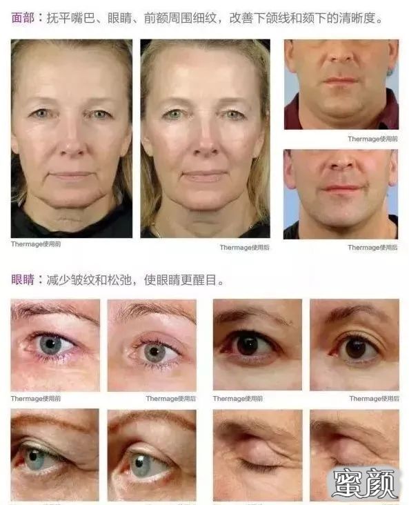 https://img.miyanlife.com/mnt/timg/201227/13423aE7-3.jpg