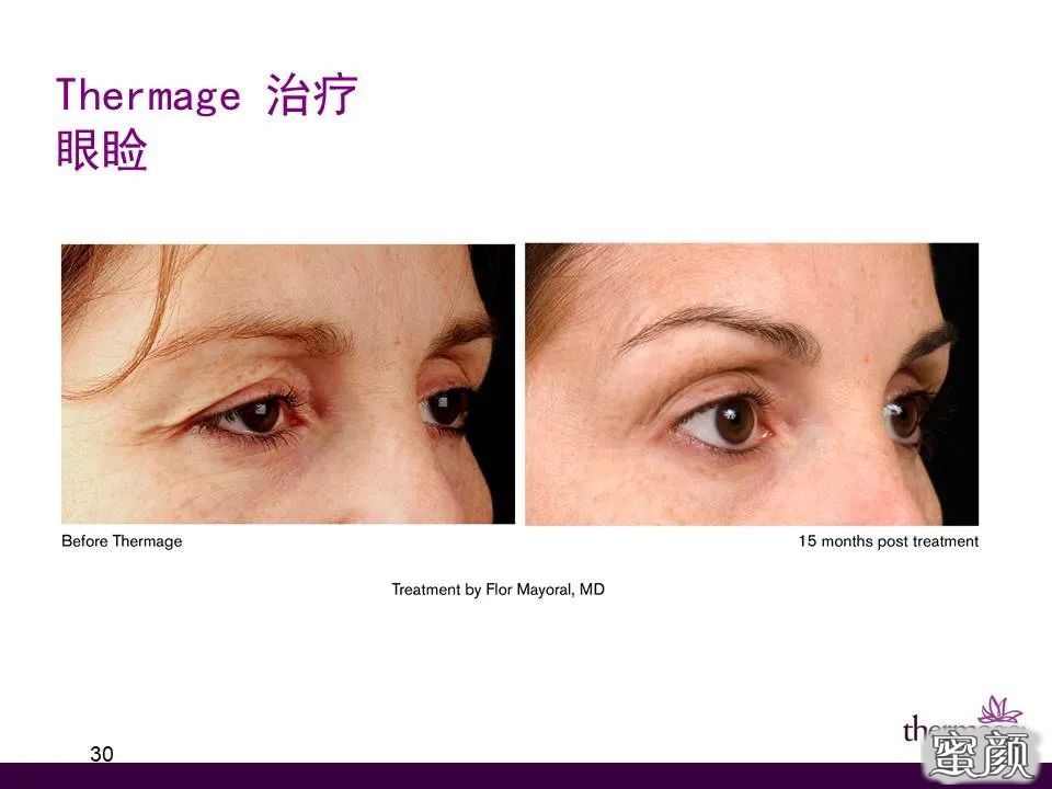 https://img.miyanlife.com/mnt/timg/201227/1536003136-2.jpg
