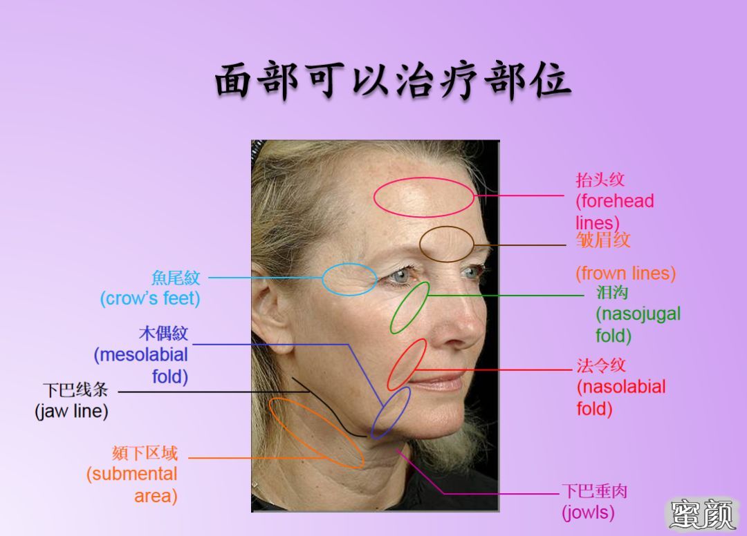 https://img.miyanlife.com/mnt/timg/201227/153H132E-7.jpg