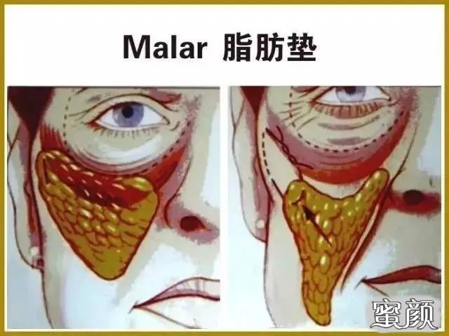 https://img.miyanlife.com/mnt/timg/201227/153JV404-2.jpg