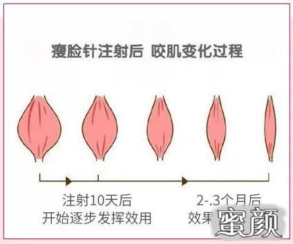 案例图片