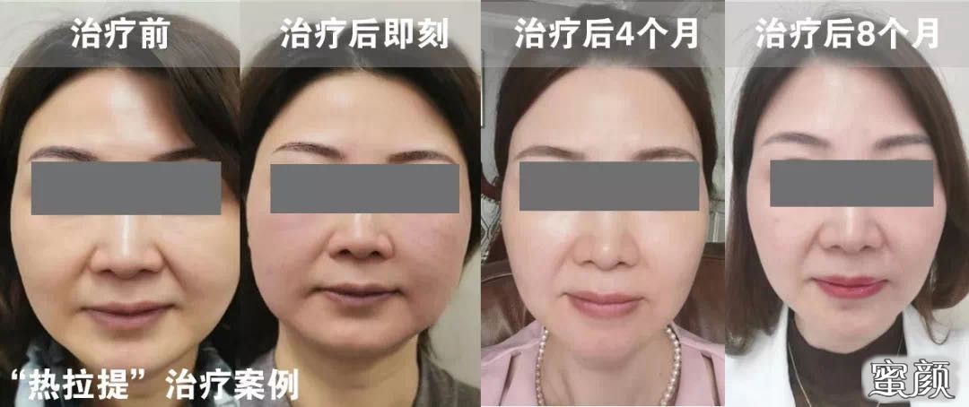 https://img.miyanlife.com/mnt/timg/201229/21022C056-5.jpg