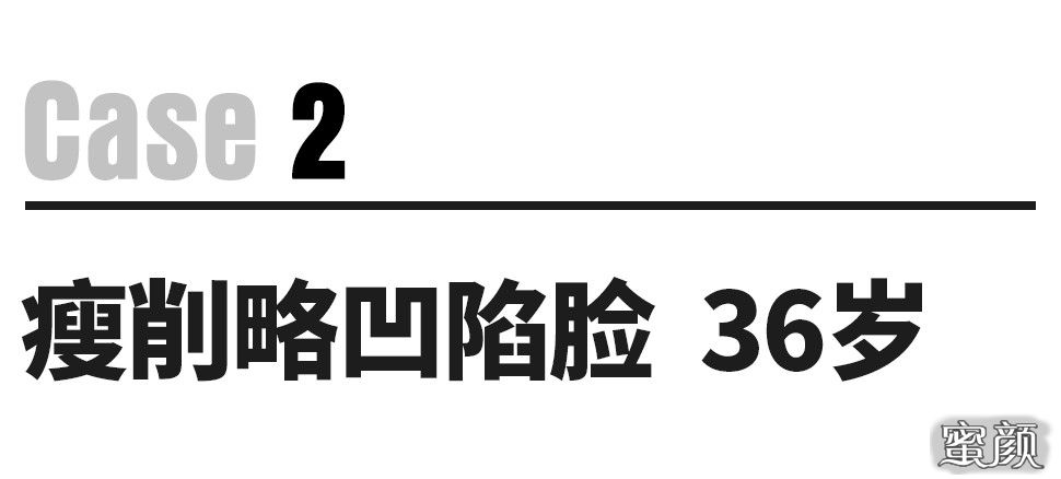 https://img.miyanlife.com/mnt/timg/201229/21034B119-9.jpg