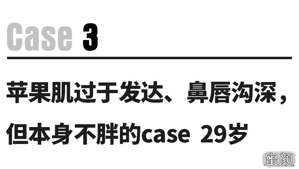 https://img.miyanlife.com/mnt/timg/201229/2103552962-11.jpg