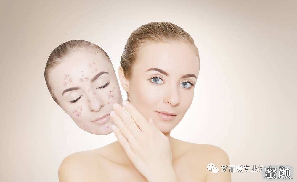 https://img.miyanlife.com/mnt/timg/210103/10040360I-0.jpg