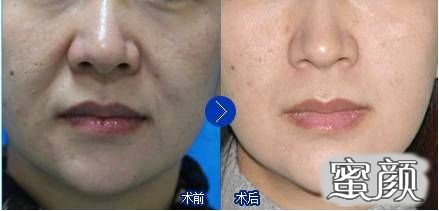 https://img.miyanlife.com/mnt/timg/210103/113G013U-2.jpg