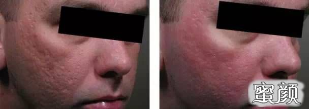 https://img.miyanlife.com/mnt/timg/210103/15555930G-3.jpg